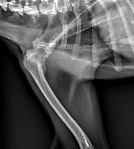 骨肉腫 レントゲン像